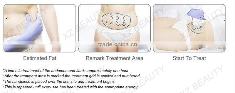 best sliming beauty equipment /slimming weight loss device/hifu slimming machine