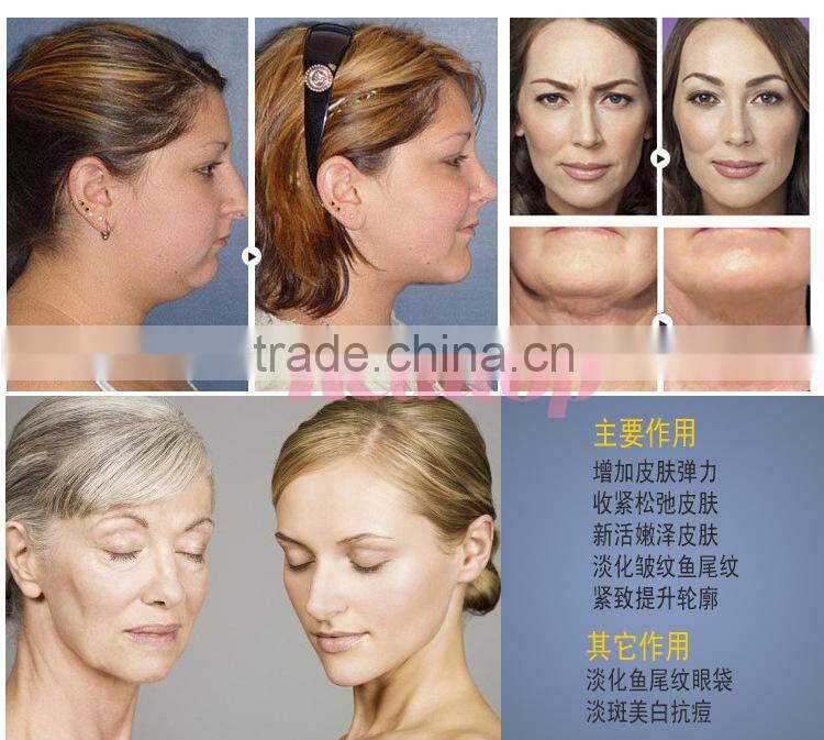 2016 Best price portable fractional rf wrinkle removal face lift skin rejuvenation machine for home use or salon