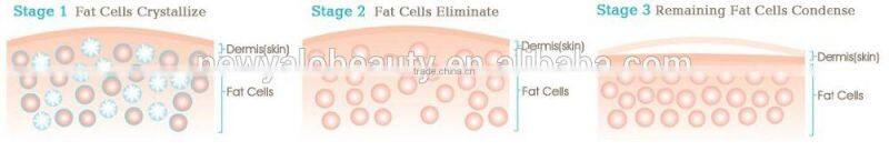 cheapest portable ultrasound machine laser weight loss slimming machine with CE