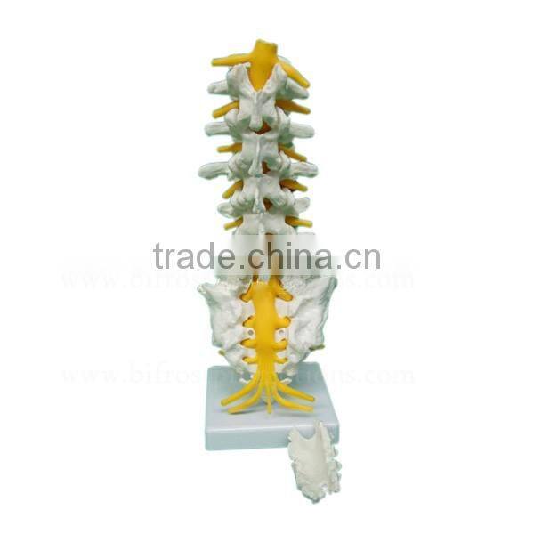 Life-size 5 Pcs Anatomical Lumbar Vertebra Model