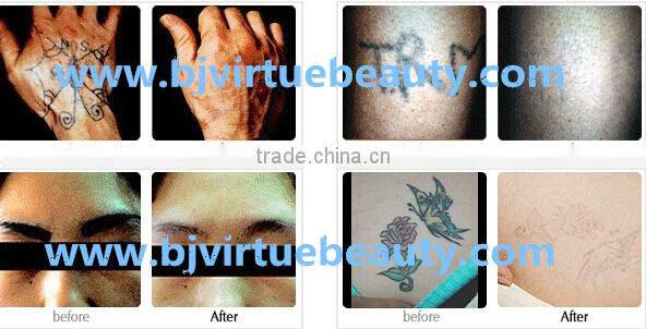 Beauty equipment multifunctional machine hair removal 2015