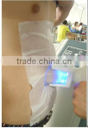 Fat freezing cryo cooler cryo liposuction cryo slimming machine with RF