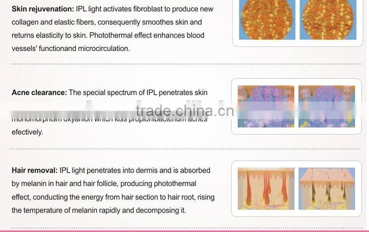 Mini home use IPL for hair removal skin rejuvenation beauty machine