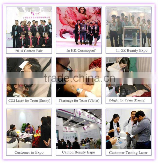 ND100 Alibaba Express!! CE salon beauty equipment spot removal tattoo removal q-switch nd:yag laser