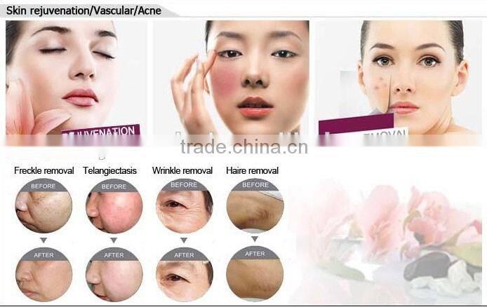 Beauty instrument durable USA imported elight shr xenon lamp