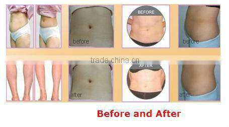 Full body shaping ultrasonic liposuction cavitation equipment
