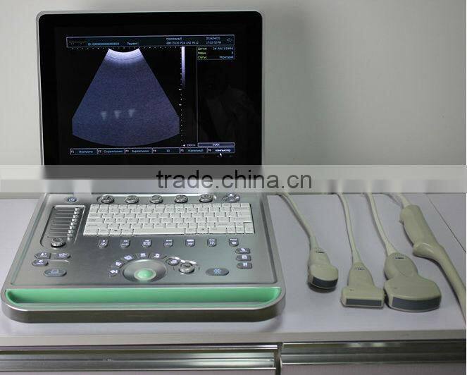 Hot Sale Full Digital Technology Ultrasound Scanner/ Echographe With Ce And Iso