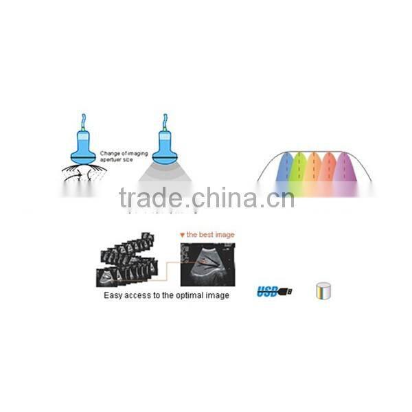 Portable Ultrasound Machine/Portable Ultrasound Scanner/Portable Ultrasound Manufacture Supplies- BPU09