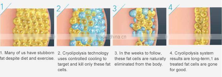 Micro machine cold body sculpting machine fat freezing cryolipolysis machine for home use