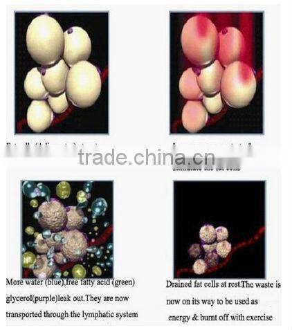 E6 advanced elight ipl hair removal Q-switch ND AYG tattoo removal machine