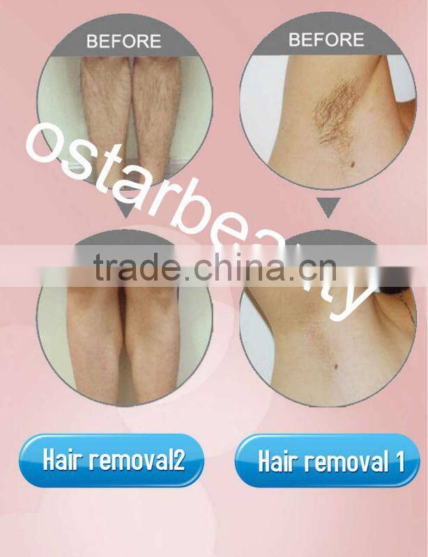 Diode laser for hair removal Laser Equipment Portable home use laser machine DH 04