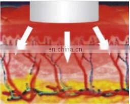 Professional GSD Vibration New Technology Roller Suction RF Face Laser Beauty Vacuum Cool HIFU Body Slimming Machine Omnislim