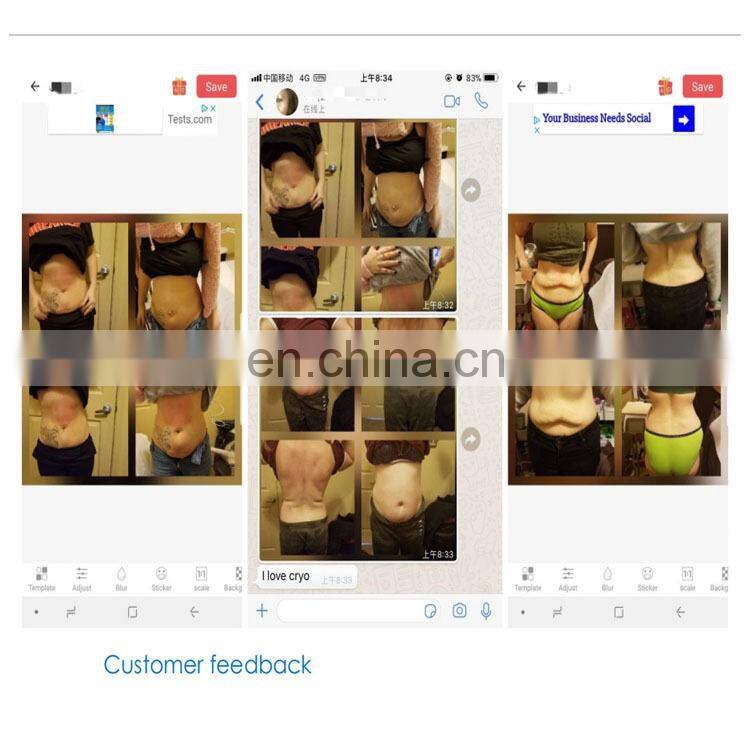 Sales Best Selling Criolipolisis Machine Cryolipolysis Price with chock wave function