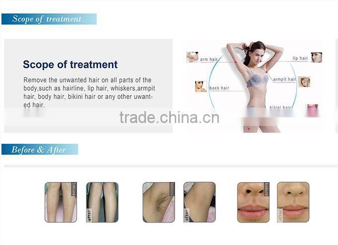 Y8B Powerful 808nm Diode Laser Hair Removal Machine