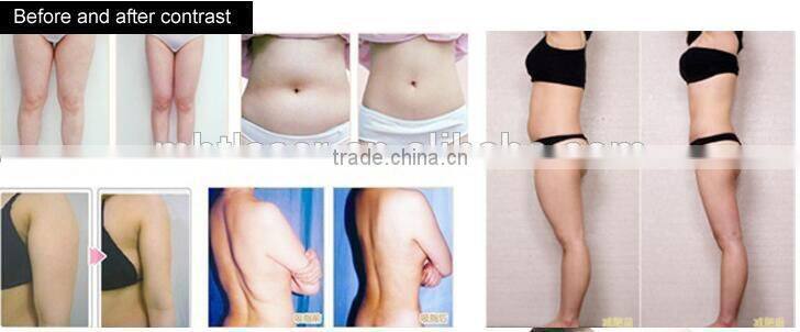 Factory Stock 4 Handpiece In 1 Macine 940nm Near-Infrared Laser + Bipolar RF + Rollers and vacuum cavitation slimimg machine