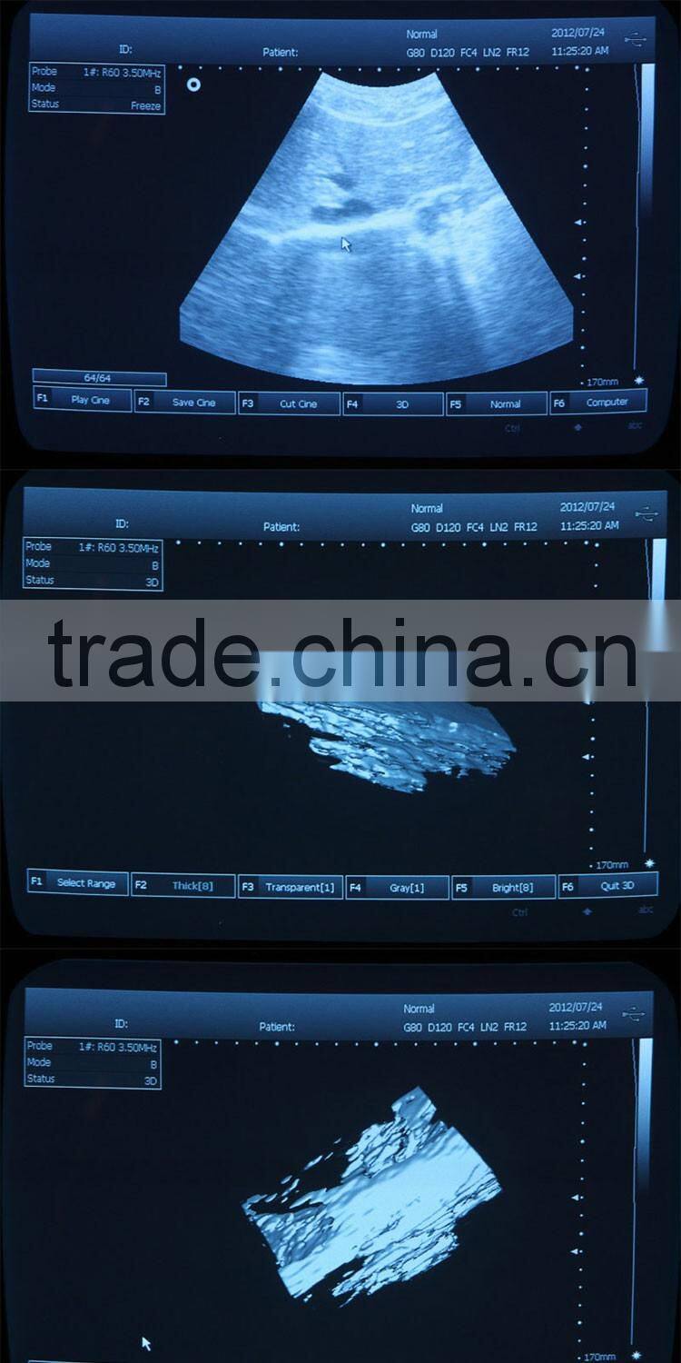 Lowe Price Medical Equipment Portable Cheap ultrasound Scanner/Machine 3.5Mhz multi-frequency Convex Probe