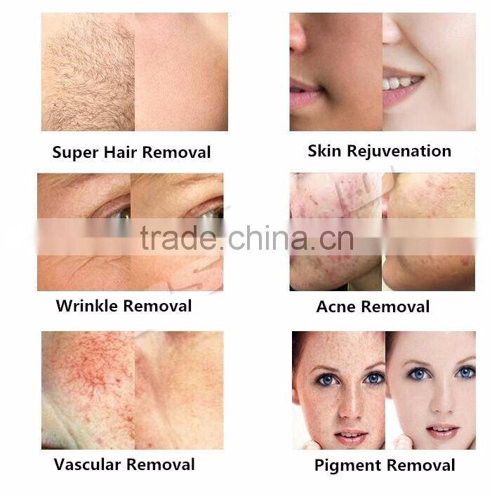 portable home hair removal laser IPL/ ipl permanent hair removal shr