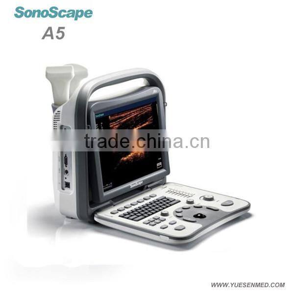 4D Sonoscape S6 Portable ultrasound machine color doppler