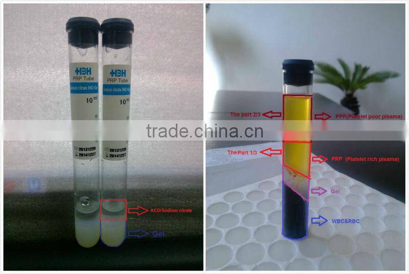 Platelet Rich Plasma PRP Tube