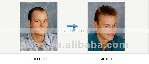 Super Durable Thin Skin toupee Fast Delivery