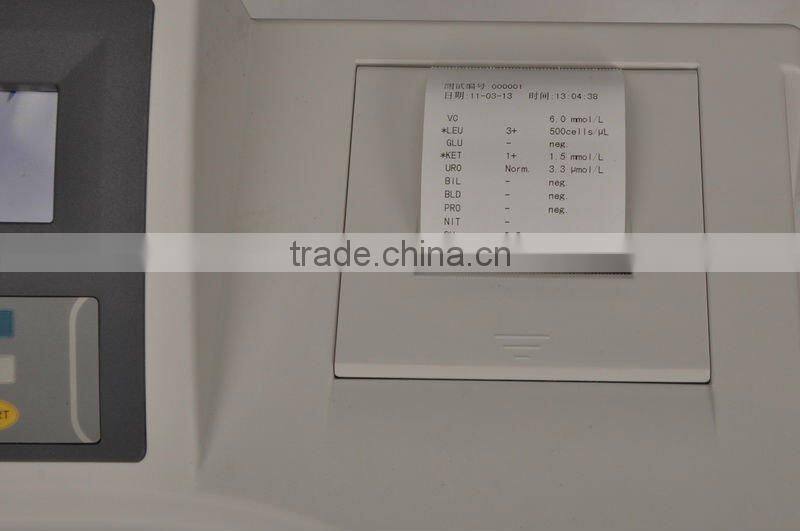 Auto Malfunction Detection Urine Analyzer