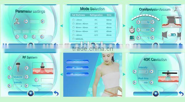 factory provide hottest criolipolisis lipo cryo fat freezing machine 2 handles cryolipolysis body sculpting