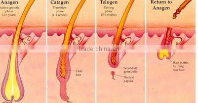 Sanhe CE approved 808nm diode laser hair removal / 808nm didoe laser hair removal machine