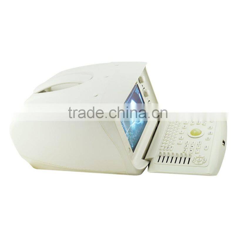 High sensitivity Trolley style Digital Portable Ultrasound Scanner with 2 probe connector