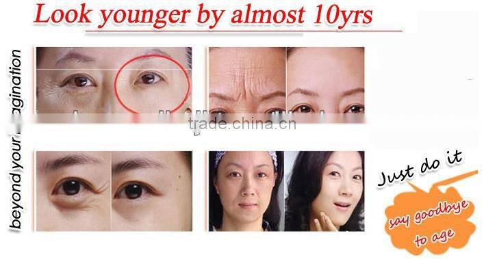 hm-rf-a100 monopolar