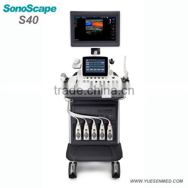 Mobile color Doppler system 3D 4D S11 Sonoscape echography