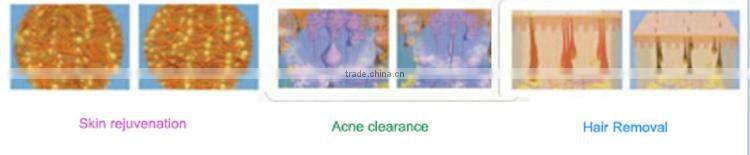 oem odm Mini IPL permanent hair removal beauty equipment with replaceable lamp