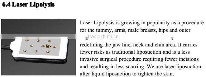 Best products cryolipolysis cool shape machine/portable cryolipolysis machine beco