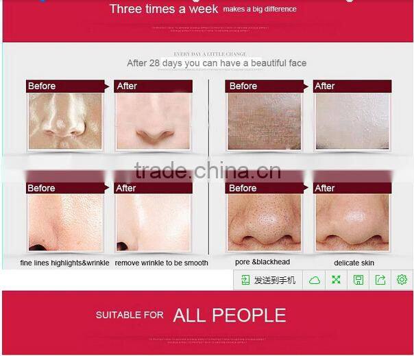 Home Ultrasound Cavitation RF Slimming Machine