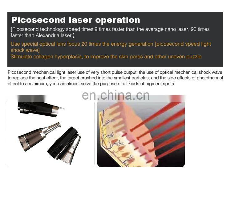 2019 Hot Nd Yag carbon facial laser picosecond tattoo removal machine