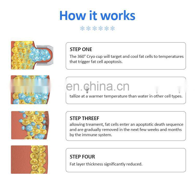 360 Fat Freeze -15 etg50 4s Cyro Fat Freezing Cryolipolysis Equipments