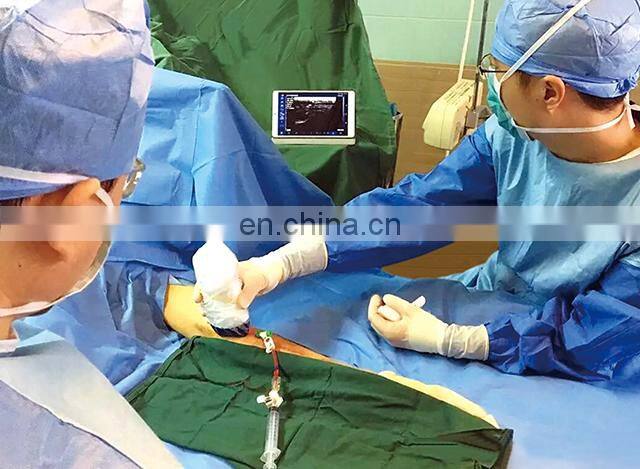 Sales 2022 factory price portable wireless ultrasound scanner ultrasound machine