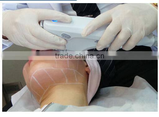 latest products in market face lift HIFU High Intensity Focused Ultrasound System
