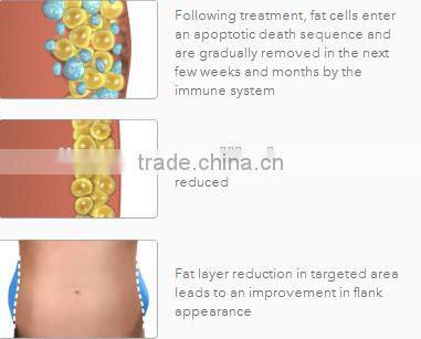 Cryotherapy fat freezing Cryotherapy equipment Cryotherapy machine for sale