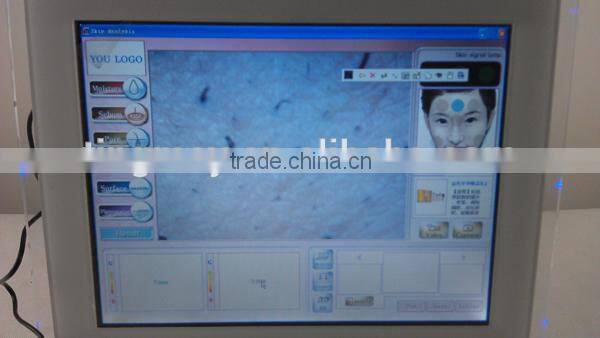 Portable Facial Skin Analyzer