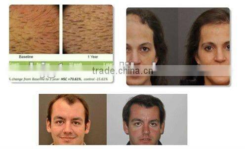 micro needle derma system GTO distributors wanted new produced micro needle derma roller