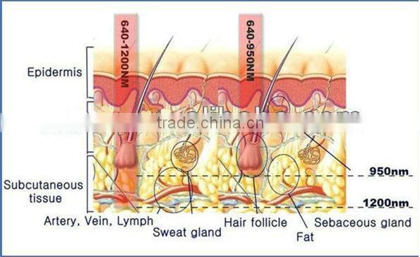 Super hair removal/ ipl shr hair removal machine with big spot
