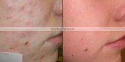 professional red led light mask led light therapy skin tightening machine