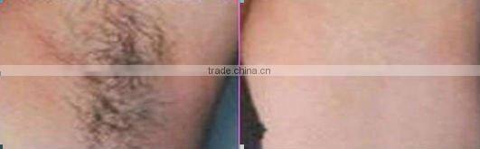 E Light Ipl & Rf Hair Removal Skin Rejuvenation on sale