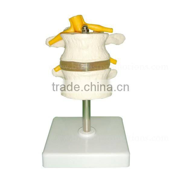 Human Body Anatomy Spine Model Lumbar Vertebra