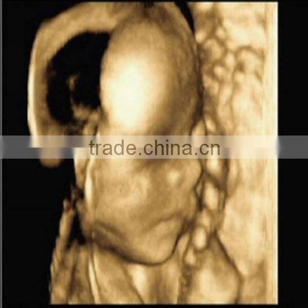 MEIQING x-ray film/hospital film/inkjet printing ultrasound film