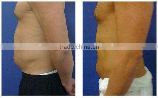 slimming machine reduce cellulite hot sale -F017