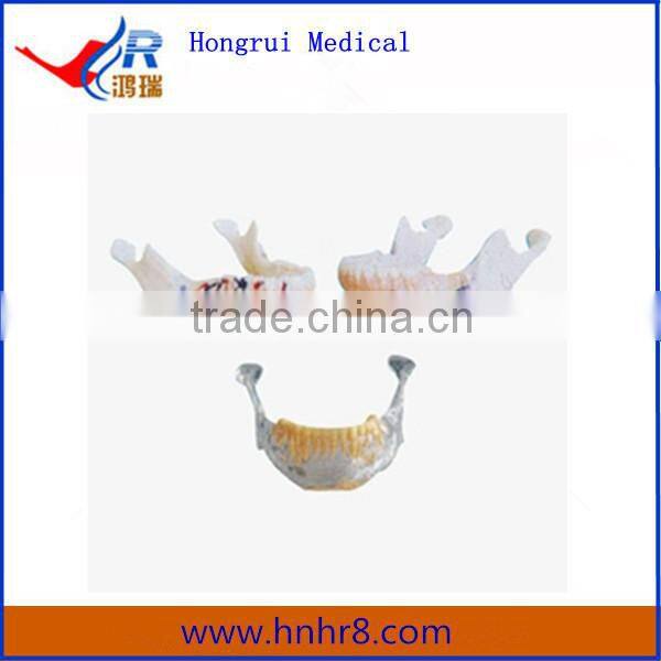 Hot Sale Mandibular Teeth Anatomical Model