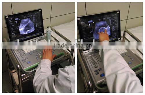C7 KONTED 3D Portable Color Doppler Ultrasound Machine