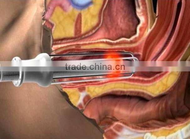 co2 laser power supply Professional fractional co2 laser machine(manufacturer) / fractional laser co2 Vaginal tightening