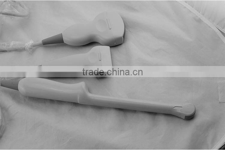1 USB factory price OEM design 80 elements R60 ultrasound scanner for pregnancy